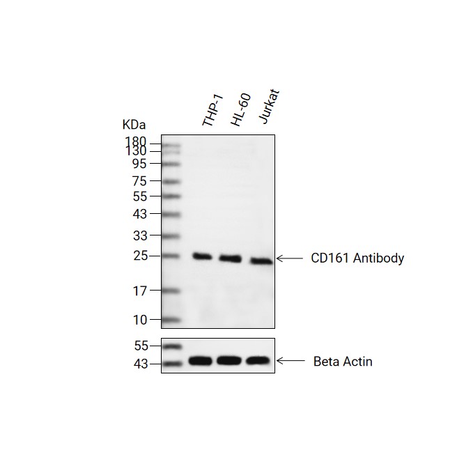 CD161抗体 (YA853)