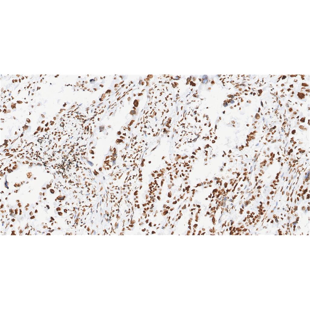 Phospho-JAK2 (Tyr1007/1008)抗体