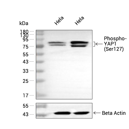 Phospho-YAP1 (Ser127)抗体 (YA136)