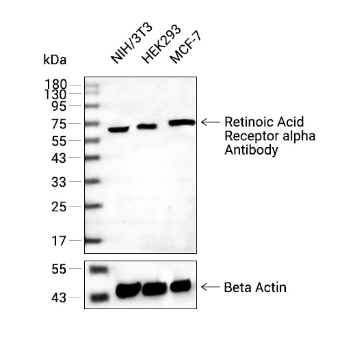 Retinoic Acid Receptor alpha抗体 (YA096)