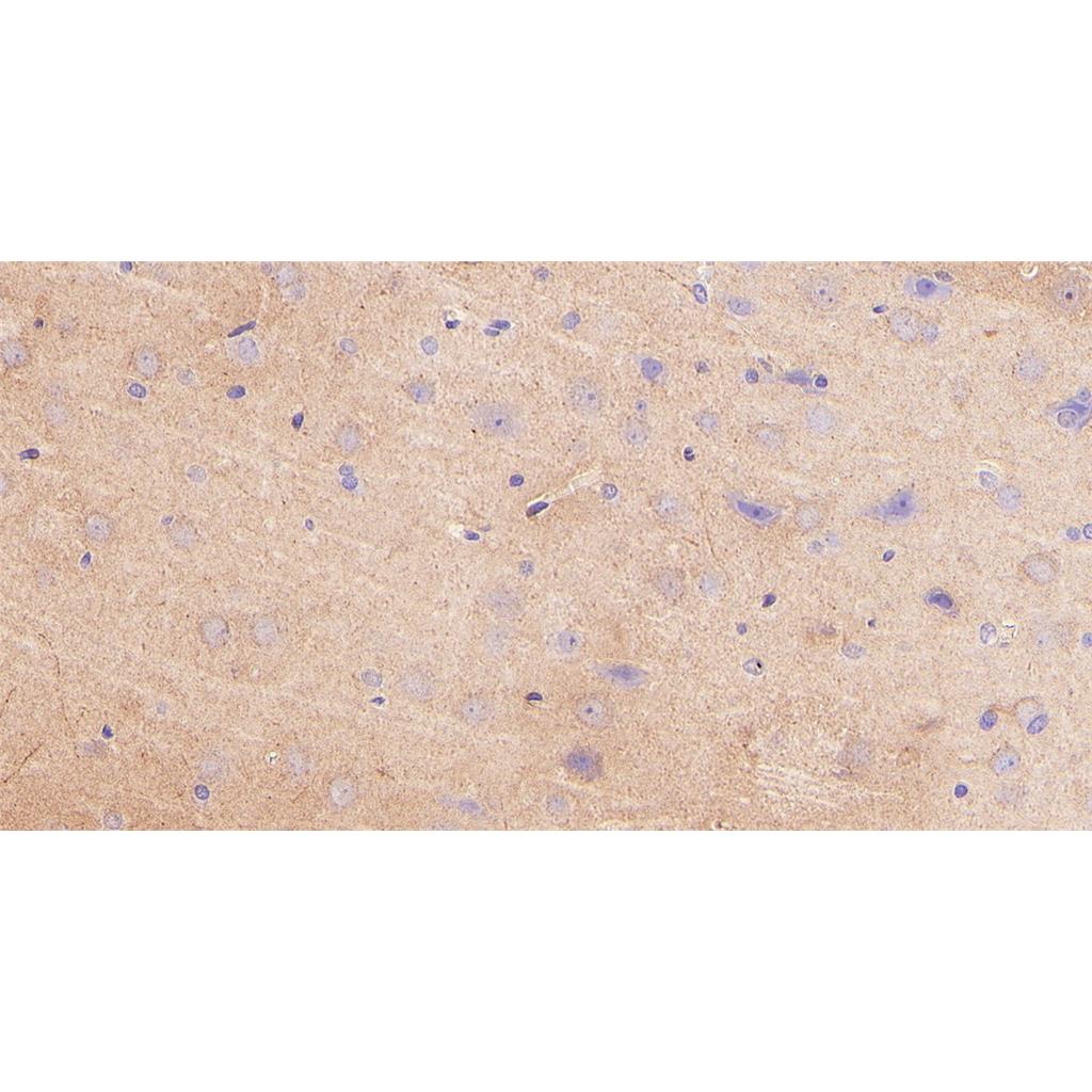 PKA 2 beta (regulatory subunit)Antibody (YA133)