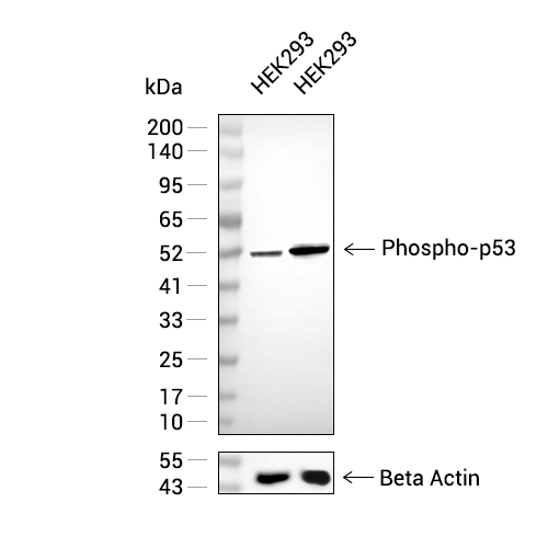Phospho-p53 (Ser392)抗体 (YA167)