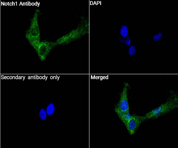 Notch1抗体