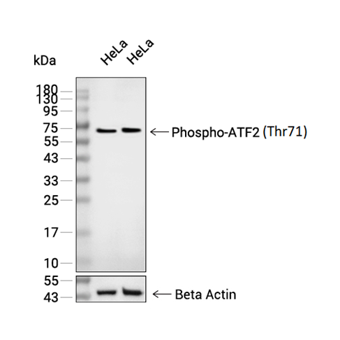 Phospho-ATF2 (Thr71)抗体 (YA224)