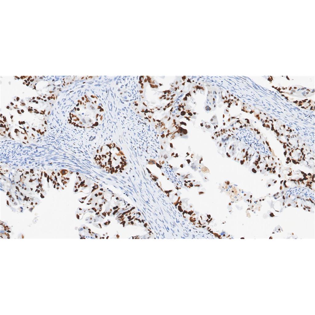 Phospho-Chk2 (Thr68)抗体