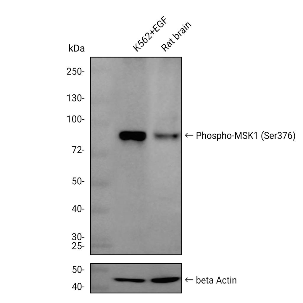 Phospho-MSK1 (Ser376)抗体 (YA172)