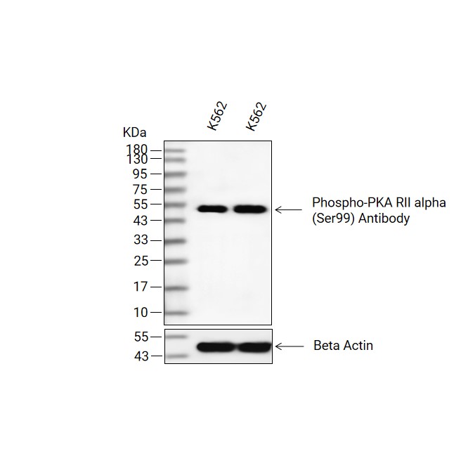 Phospho-PKA R2/PKR2 (Ser99)抗体