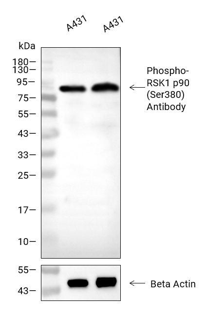 Phospho-RSK1 p90 (Ser380)抗体 (YA158)