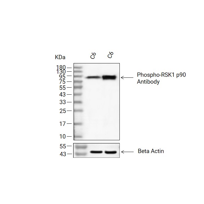 Phospho-RSK1 p90 (Thr359/Ser363)抗体 (YA157)