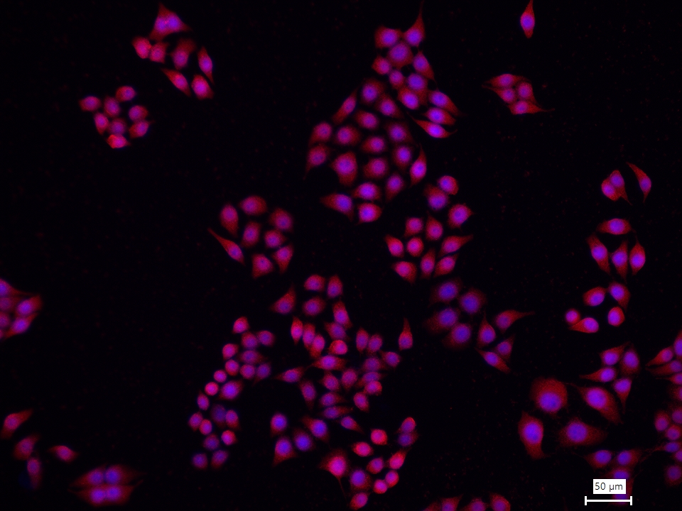 Cytokeratin 19抗体