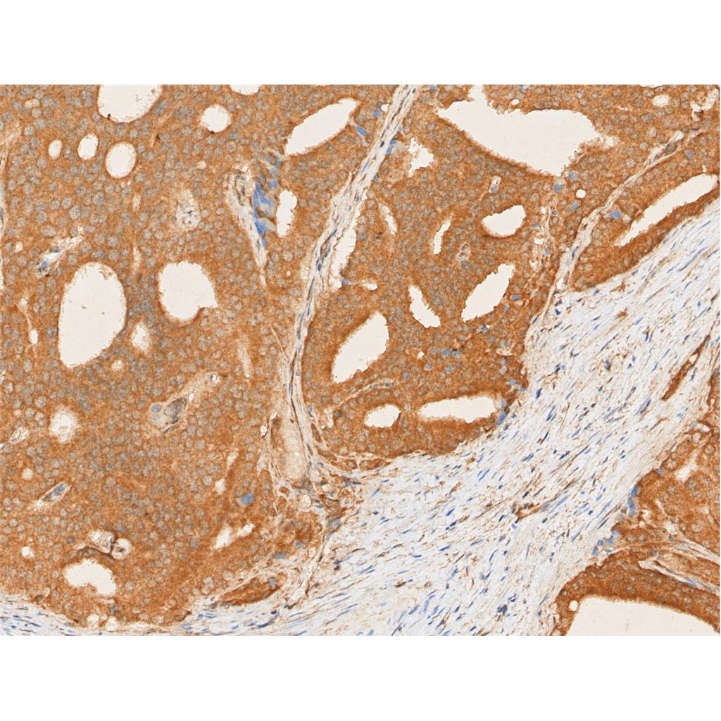 Phospho-PERK (Thr980)抗体