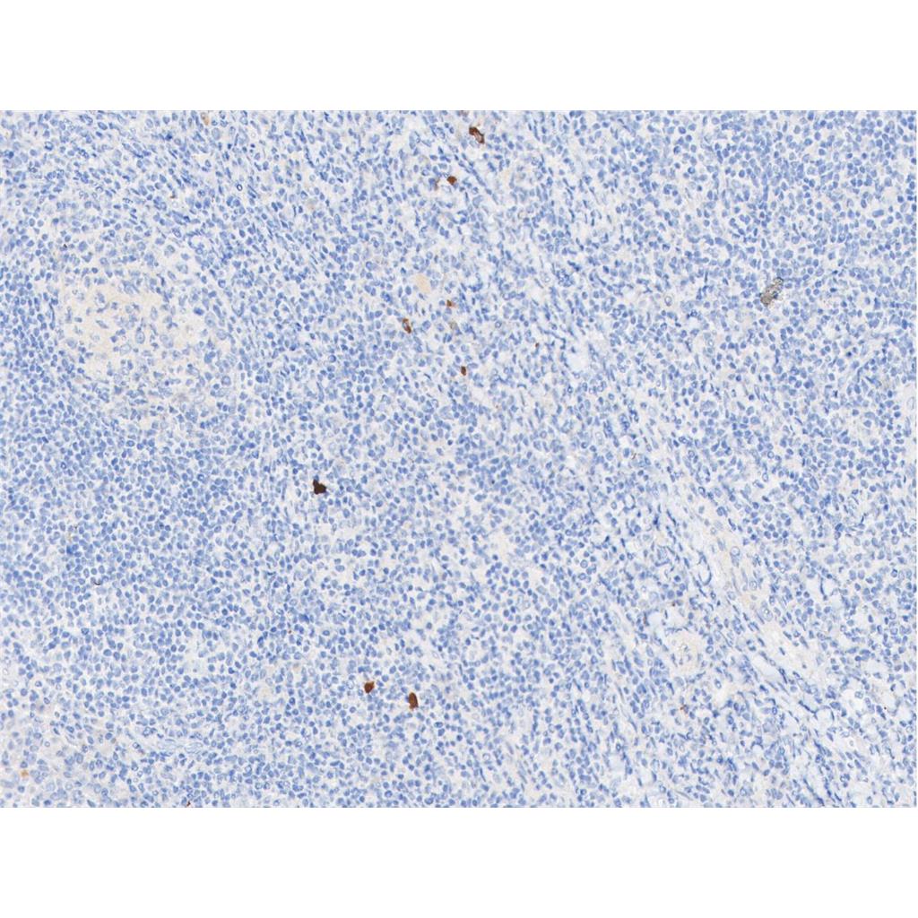 phospho-LATS1+LATS2 (Thr1079 +Thr1041)抗体