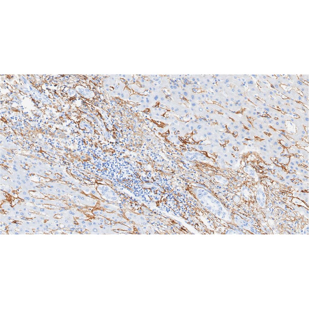 p75 NGF Receptor抗体 (YA1245)