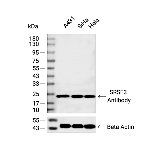SRSF3抗体 (YA2169)