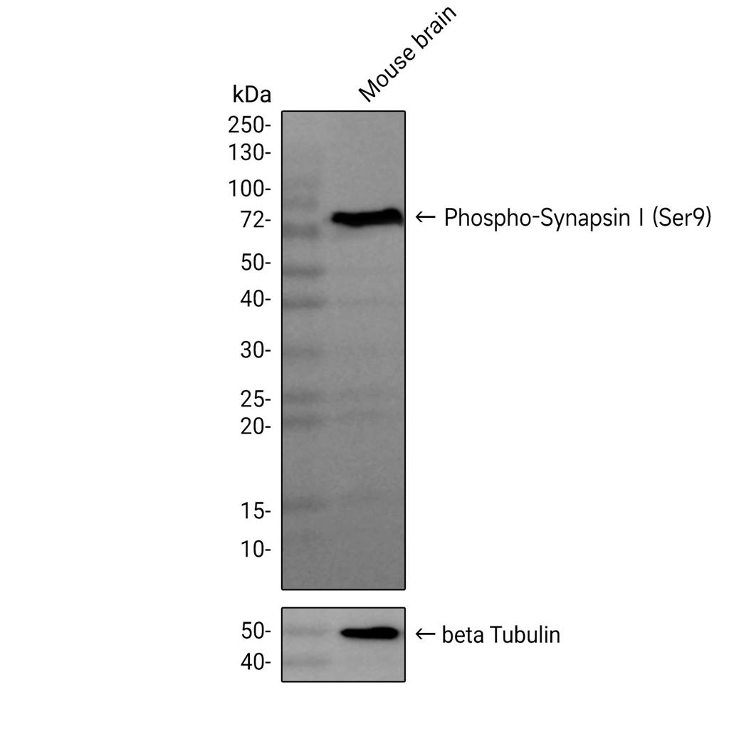 Phospho-Synapsin I (Ser9)抗体 (YA1864)