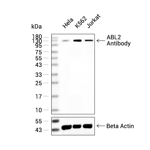 ABL2抗体 (YA3203)