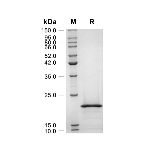 KGF-2/FGF-10蛋白, Human (169a.a)