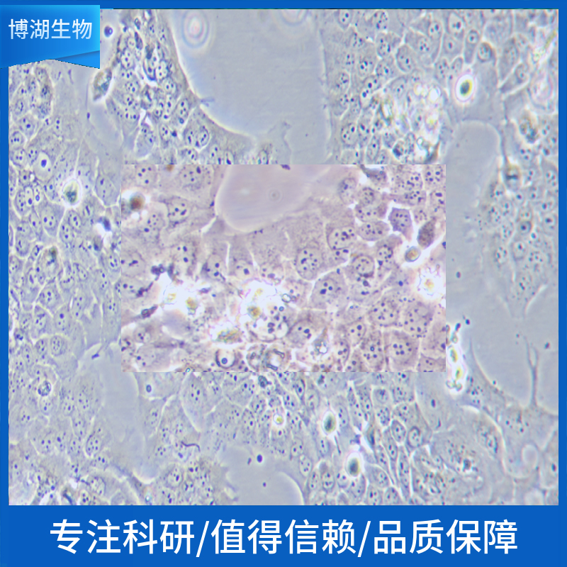 SK-BR-3人乳腺癌细胞