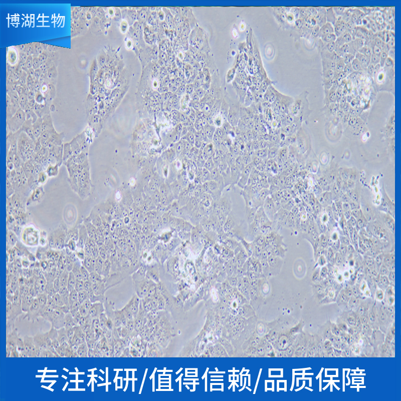 OVCAR-8人卵巢癌腺癌细胞