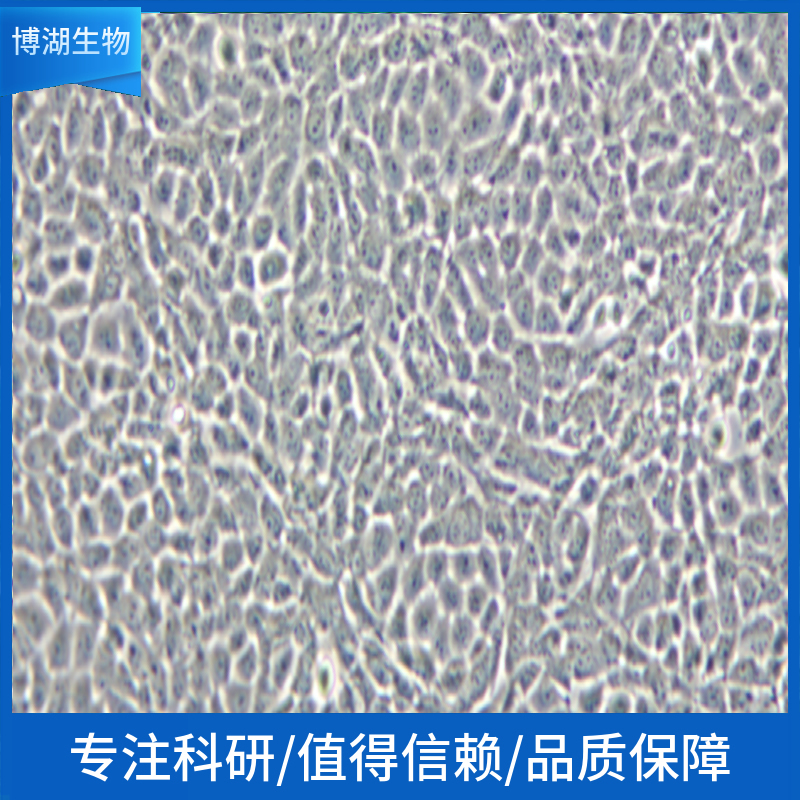 人肝癌细胞;QGY-7701