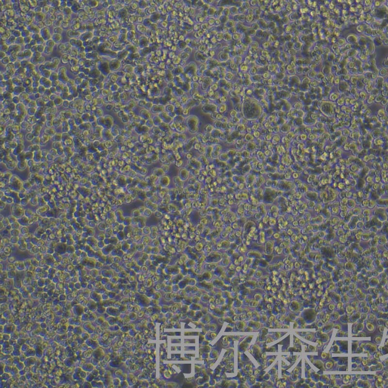 Ty-82细胞（人胸腺癌细胞）