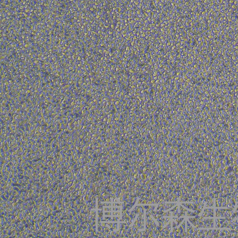 Toledo细胞（人弥漫性大B细胞淋巴瘤细胞）