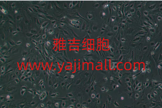 人成纤维细胞GM12611