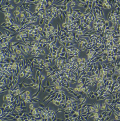 人乳腺癌细胞HHC6548 T1 M1