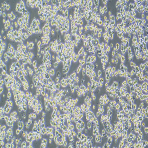 小鼠前列腺癌-荧光素酶标记Pten-CaP8-LUC