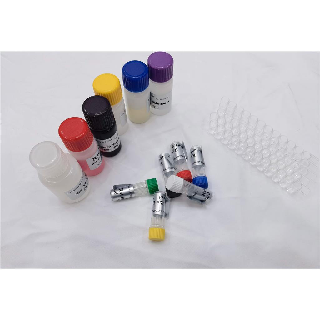 人磷酸化细胞信号转导分子SMAD-2(SMAD-2)ELISA试剂盒