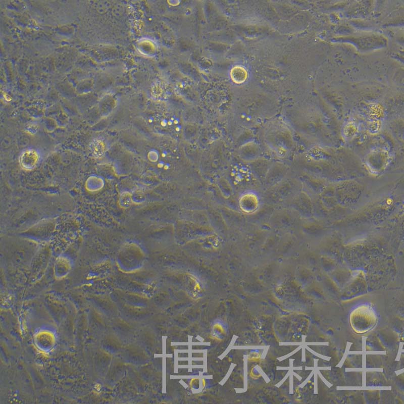 SNU878细胞（人肝癌细胞）