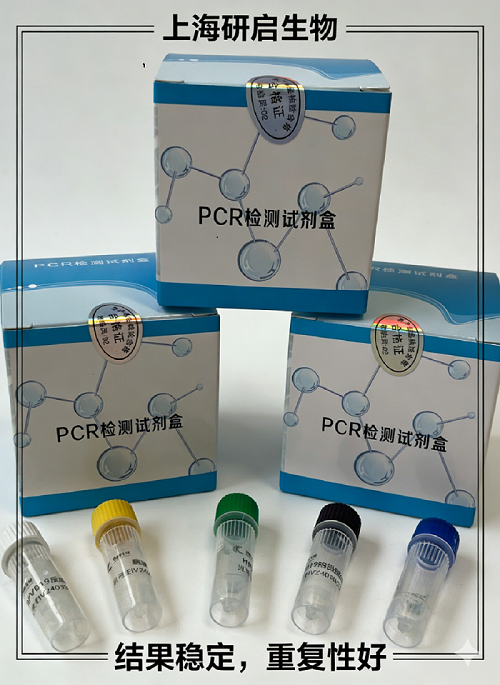 口蹄疫通用/塞尼卡谷病毒（FMDV-U/SVV）核酸检测试剂盒(双重荧光-PCR法)