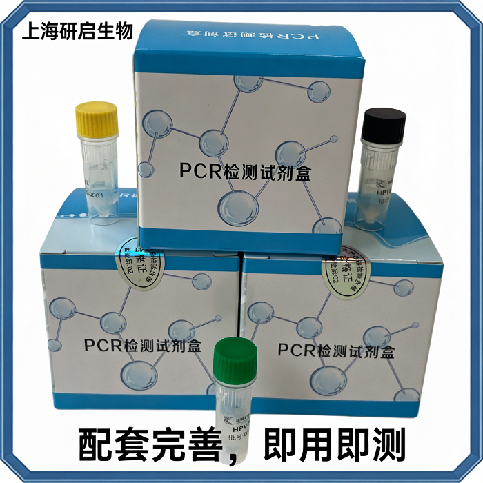 禽流感通用/新城疫病毒(AIV-U/NDV)核酸检测试剂盒(双重荧光-PCR法)