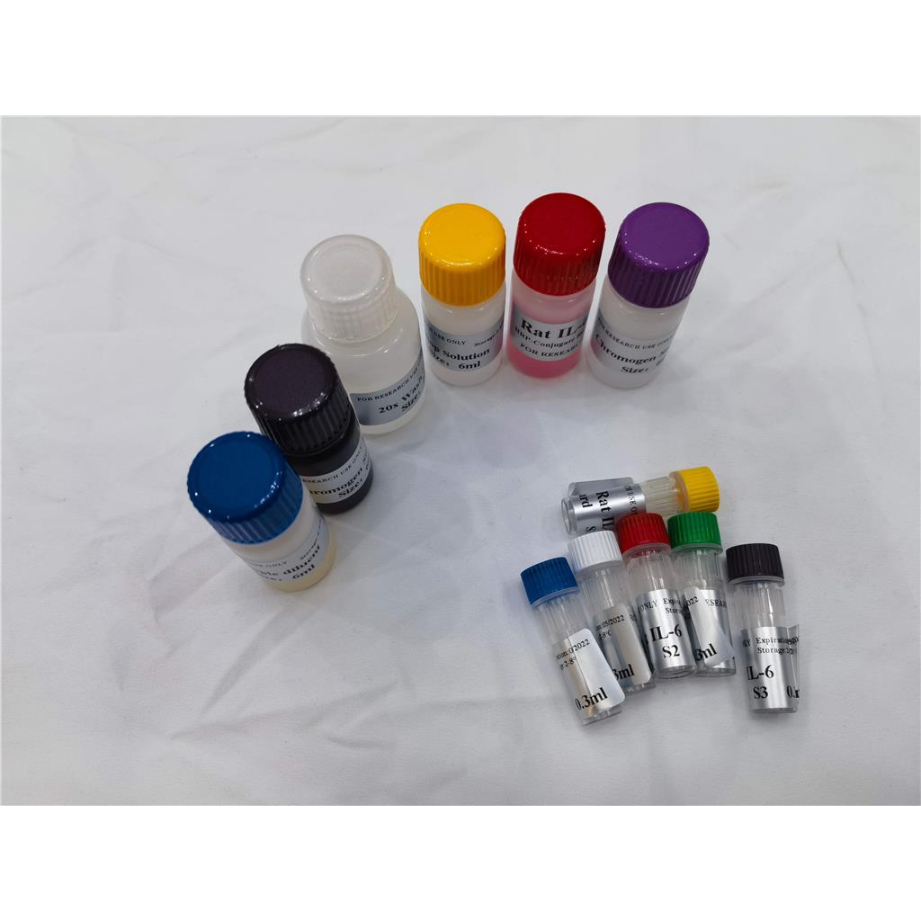 人甲胺喋呤抗体(MTX Ab)ELISA试剂盒