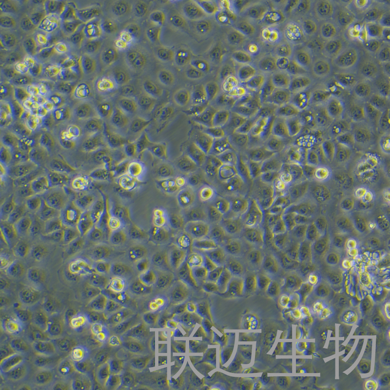 KYSE-150细胞（食管鳞癌细胞STR鉴定正确）LM8C0638