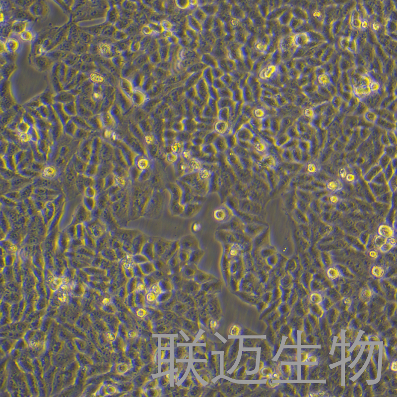 MADB106细胞（大鼠乳腺癌细胞）LM8C0148