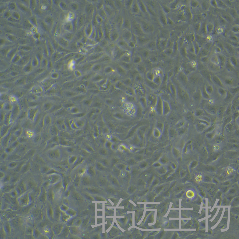 HUV-EC-C[HUVEC]细胞（脐静脉血管内皮细胞STR鉴定正确）LM8C0122