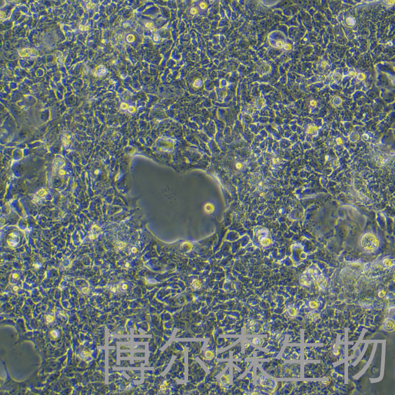 TK6细胞（人成淋巴细胞）