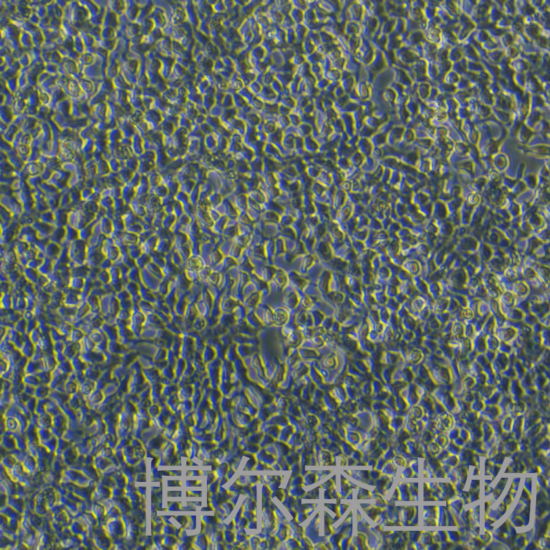 TM-31细胞（人脑星形细胞瘤）