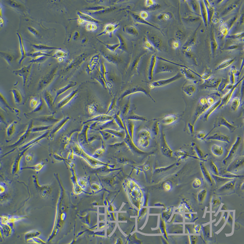 MDA-MB-231-GFP细胞（乳腺癌细胞绿色荧光蛋白标记）LM8C0150-G