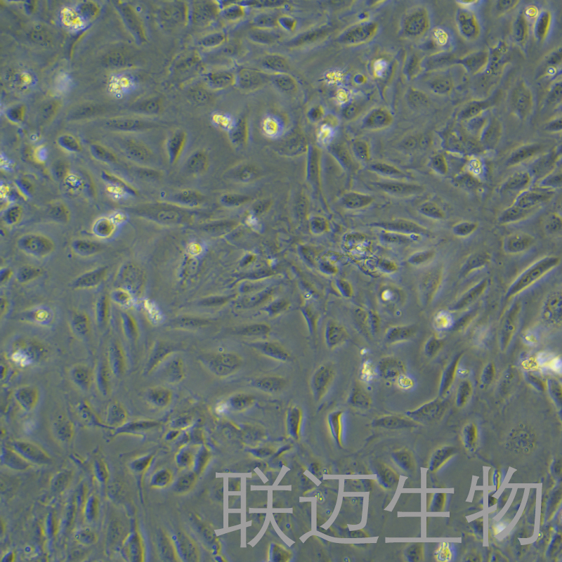 HUVEC-RFP细胞（人脐静脉血管内皮细胞带红色荧光）LM8C0122-R