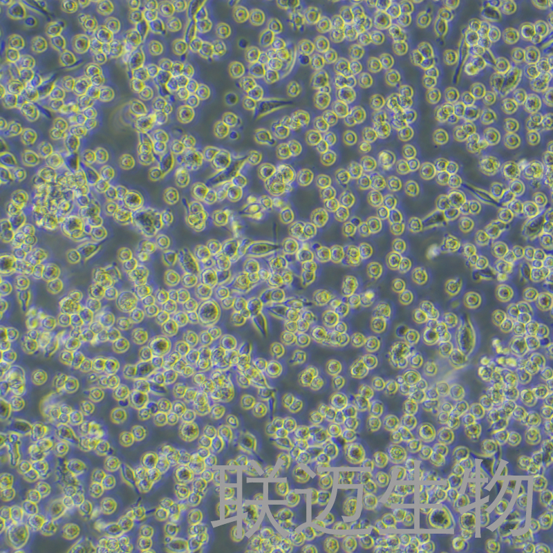 LLC-LUC-GFP细胞（小鼠肺癌细胞-绿色荧光蛋白-荧光素酶标记）LM8C0140-LG