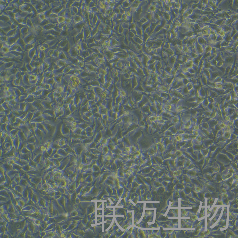 B16-F10-LUC细胞（小鼠黑色素瘤细胞荧光素酶标记）LM8C0319-L