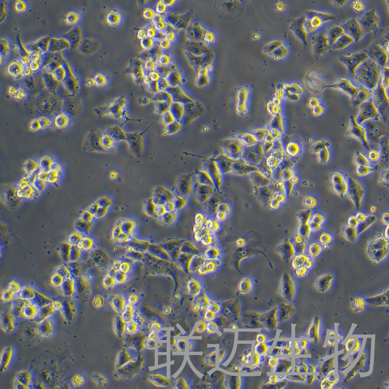 PANC-1-LUC细胞（人胰腺癌细胞带荧光素酶）LM8C0184-L