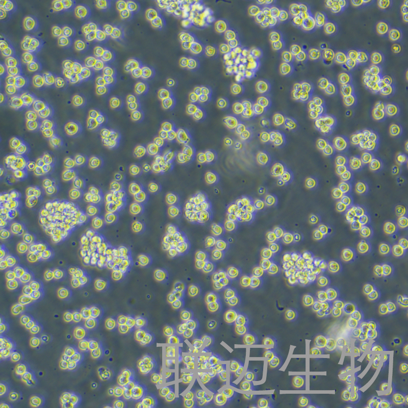 RAJI-LUC细胞（人口腔鳞癌细胞-荧光素酶标记）LM8C0189-L