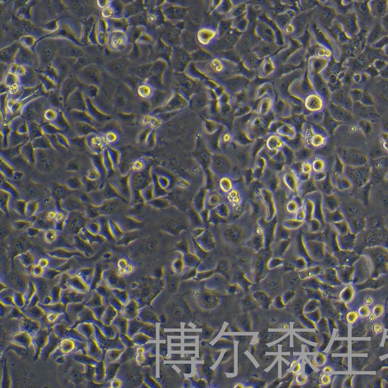 SHZ-88-LUC细胞（大鼠乳腺癌细胞-荧光素酶标记）