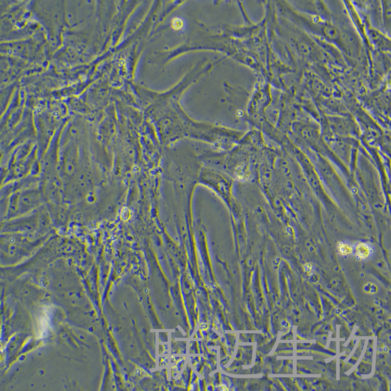 HTMC细胞（人眼小梁网细胞）LM8C0697