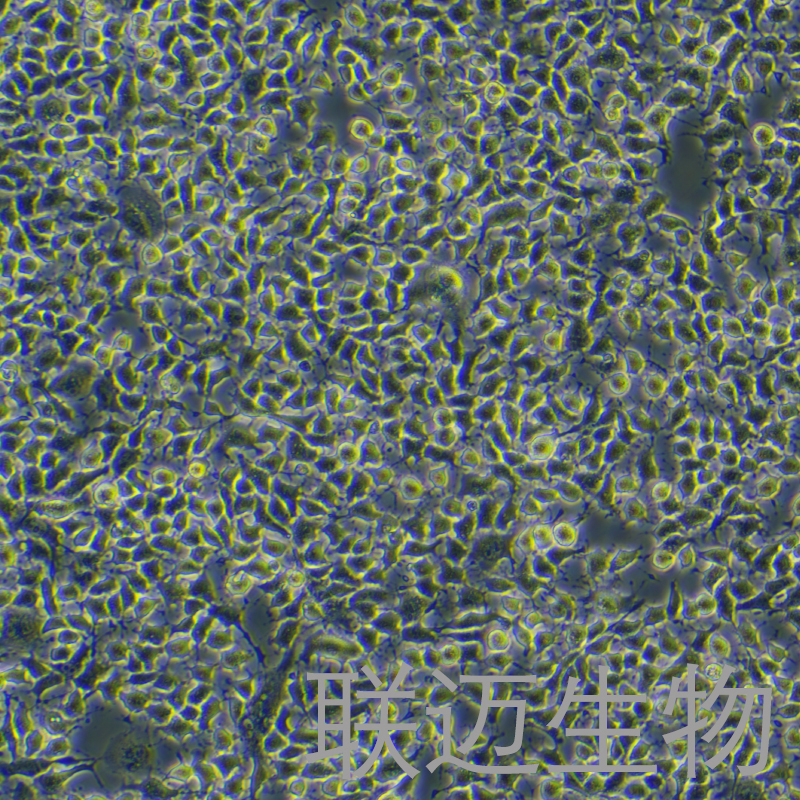 E0771细胞（小鼠乳腺癌细胞）LM8C0711