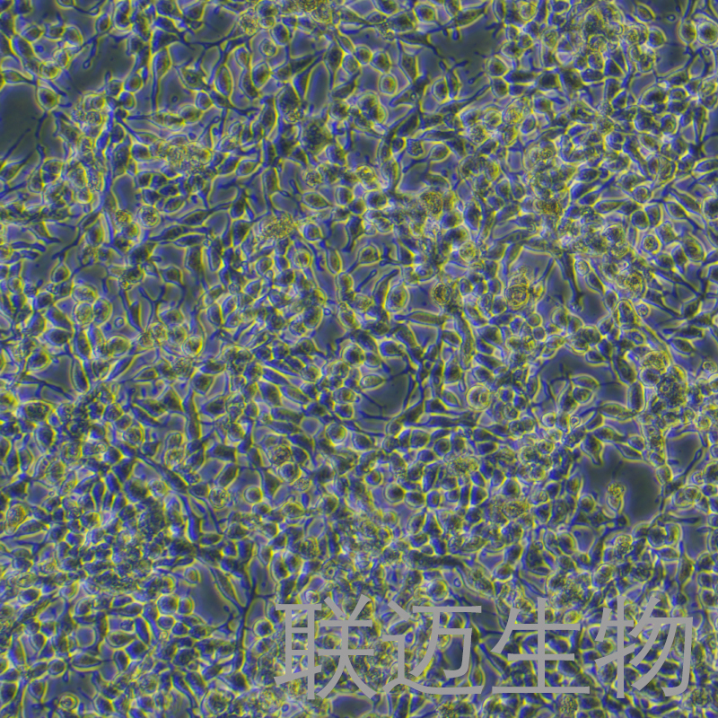 Lncap细胞（前列腺癌细胞）LM8C0702
