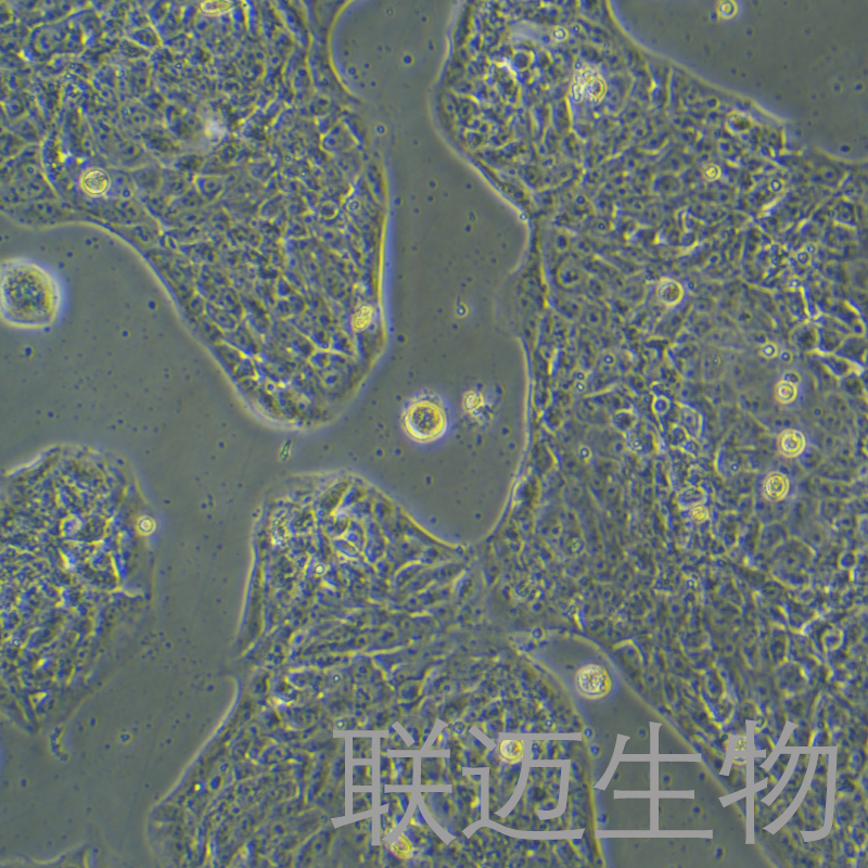 LCLC97TM1细胞（大细胞肺癌）LM8C0724